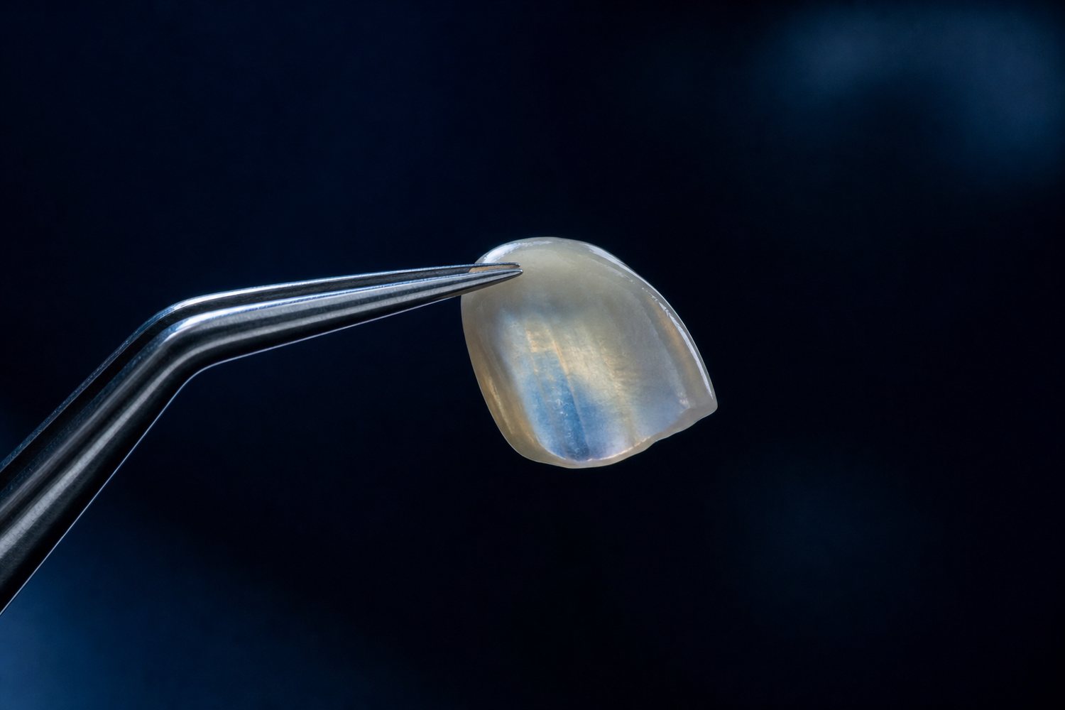 Dental lab materials and digital workflow at Smile Club Lab
