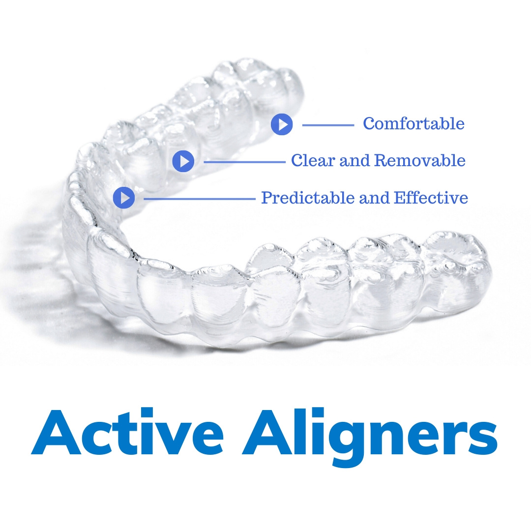 Active Aligners Top Tips for Successful Treatments