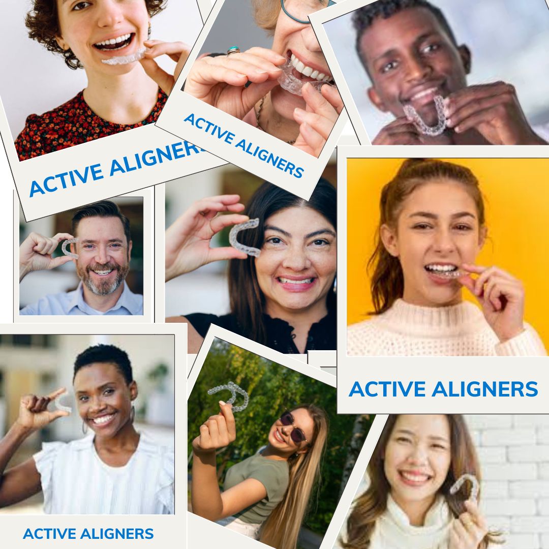 Why Active Aligners Have One of the Lowest Refinement Rates