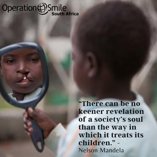 Active Aligners and Operation Smile Partnership